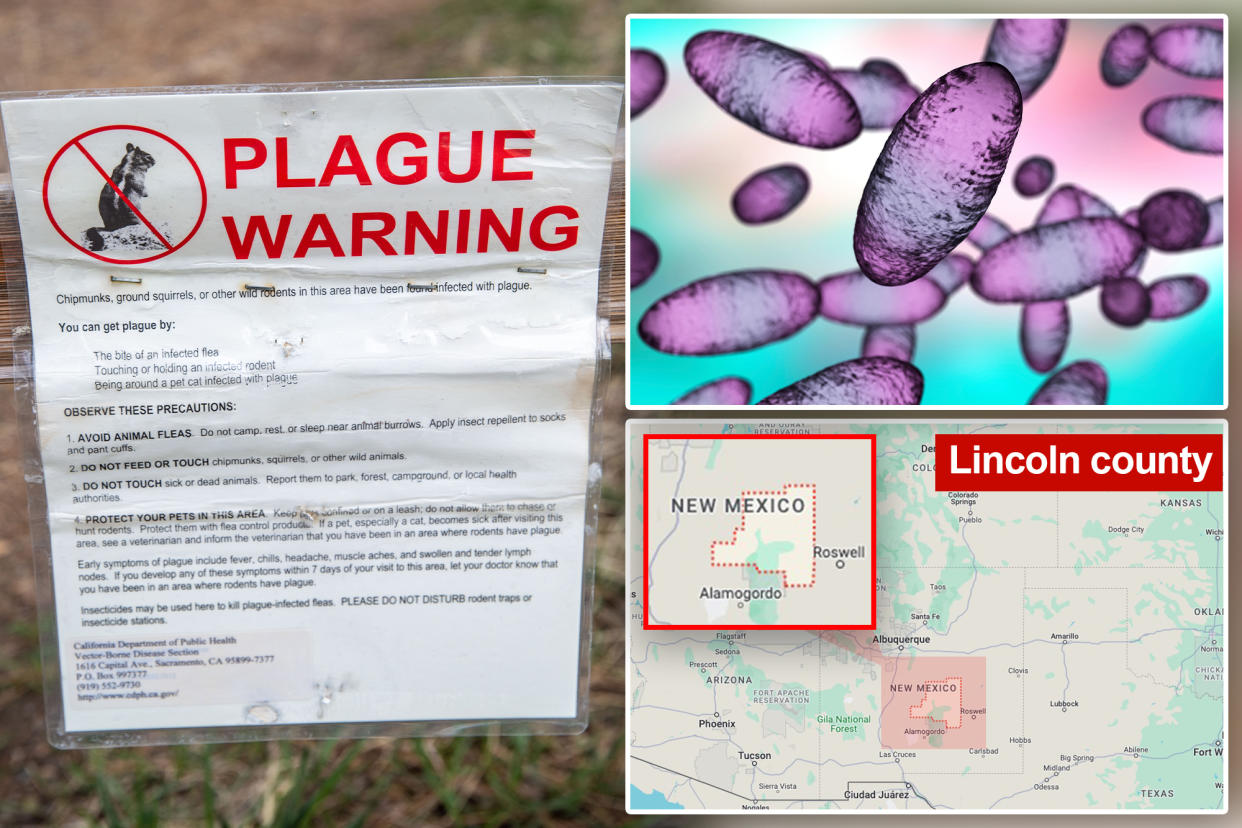 A New Mexico man has died of complications from the bubonic plague, marking the state's first recorded case of the disease since 2021.