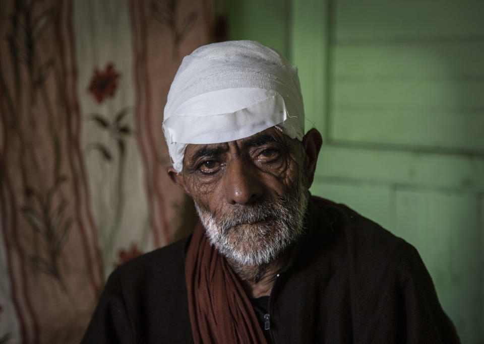 Mohammad Siduiq Kumar poses for photographs inside his home after he got injured in a bear attack at Kangan, northeast of Srinagar, Indian controlled Kashmir, Tuesday, Sept. 8, 2020. An elderly vegetable seller. Kumar was returning to his home with fodder for his cattle. Amid the long-raging deadly strife in Indian-controlled Kashmir, another conflict is silently taking its toll on the Himalayan region’s residents: the conflict between man and wild animals. According to official data, at least 67 people have been killed and 940 others injured in the past five years in attacks by wild animals in the famed Kashmir Valley, a vast collection of alpine forests, connected wetlands and waterways known as much for its idyllic vistas as for its decades-long armed conflict between Indian troops and rebels. (AP Photo/Mukhtar Khan)