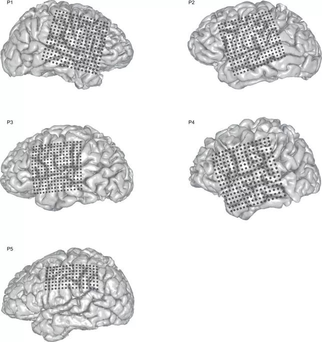 Nature重磅：華裔科學家成功解碼腦電波，AI直接從大腦中合成語音