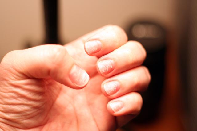 The Best Foods for Nail Growth, According to Registered Dietitians