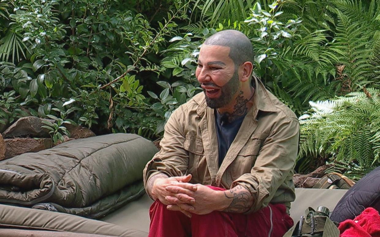 Höllische Schmerztherapie - und trotzdem ein befreites Lachen: Harald Glööckler erspart sich und den Zuschauern so gut wie nichts. "Meine ganze Kindheit war ein einziges Trauma", sagt er. Im Dschungelcamp möchte er alles aufarbeiten. "Ich Grunde bin ich auf Kur hier." (Bild: RTL)