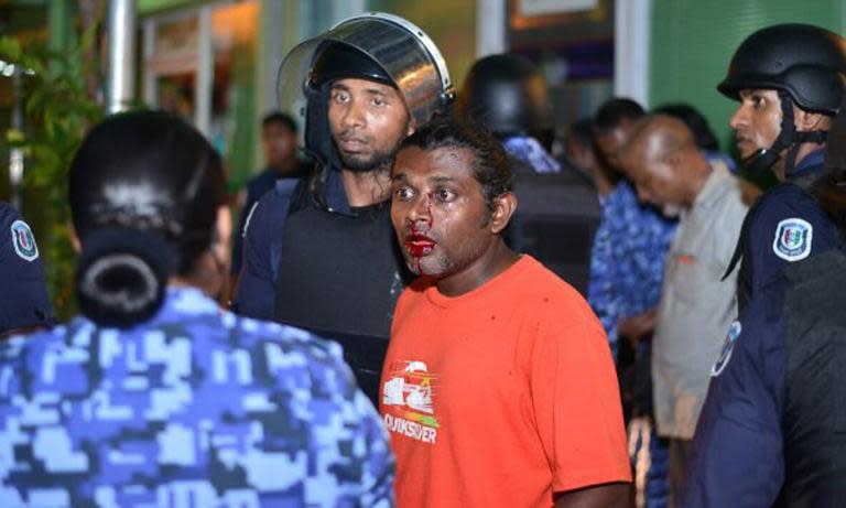 Maldives security personnel speak with an injured activist after an anti-government rally in Male, May 2, 2015