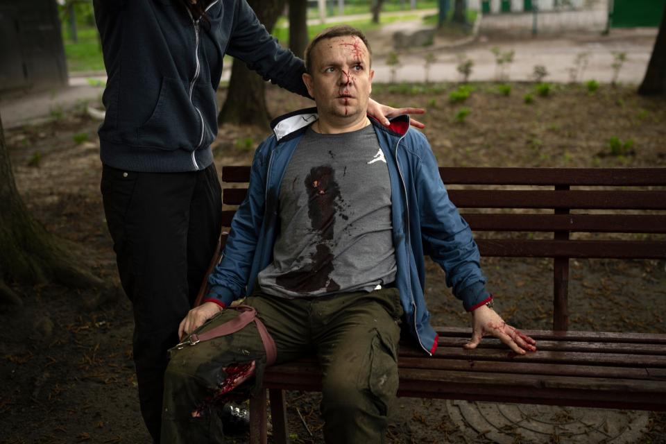 An injured man waits for emergency workers following a Russian bombardment in Kharkiv, Ukraine, Wednesday, April 27, 2022. (AP Photo/Felipe Dana) ORG XMIT: XFD101