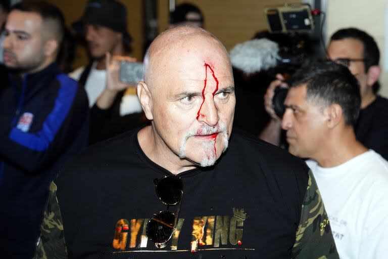 John Fury, padre de Tyson, con un corte en su cabeza luego de golpear a un ucraniano