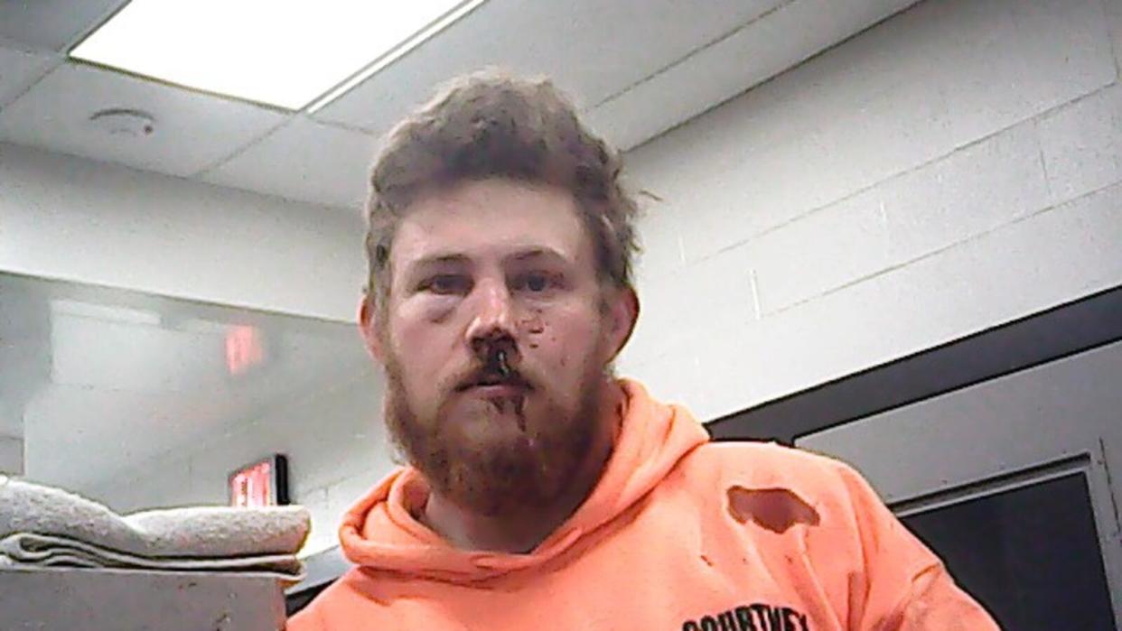 A Wright County Jail photo of Kody Skaggs following his fatal April 2023 collision that resulted in the death of Justin Sanders.