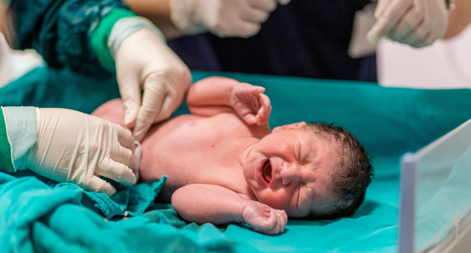 Image of a newborn baby with a doctor cutting the umbilical cord.