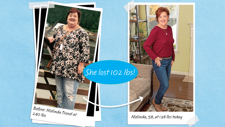 Before and after images of Melinda Troxel who lost 102 lbs using an apple cider vinegar diet plan