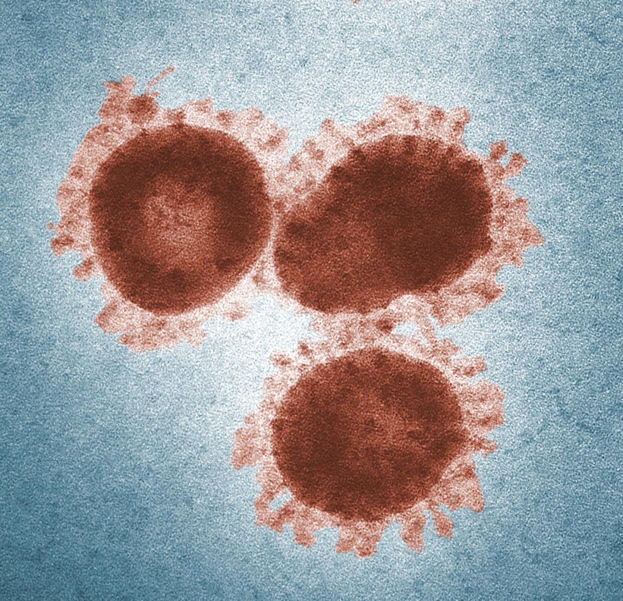 <span class="caption">A member of the coronavirus family that infects chickens.</span> <span class="attribution"><a class="link " href="https://phil.cdc.gov/Details.aspx?pid=15523" rel="nofollow noopener" target="_blank" data-ylk="slk:CDC/ Dr. Fred Murphy; Sylvia Whitfield;elm:context_link;itc:0;sec:content-canvas">CDC/ Dr. Fred Murphy; Sylvia Whitfield</a></span>