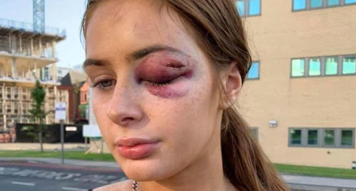 Gabrielle Walsh, 18, and a male friend were attacked in the street in Manchester following the rejection.