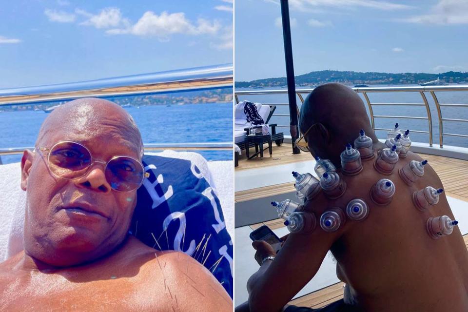 <p>Samuel L Jackson/Instagram</p> Samuel L. Jackson doing acupuncture and cupping on yacht