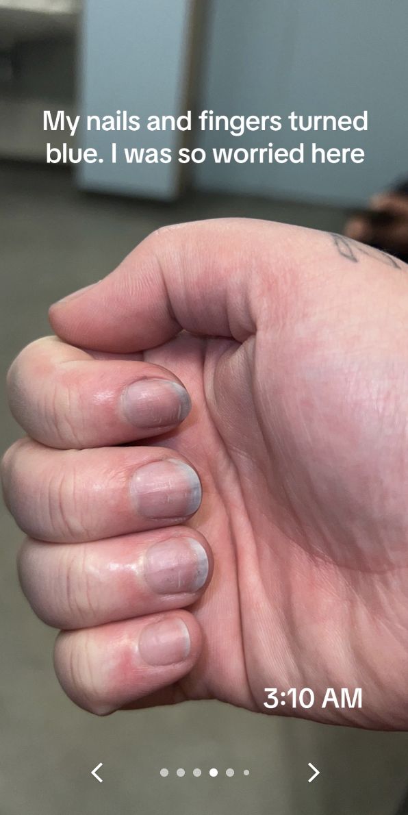 Close-up of a person's clasped hands showing nails and fingers with a bluish tint; a tattoo is visible on one finger