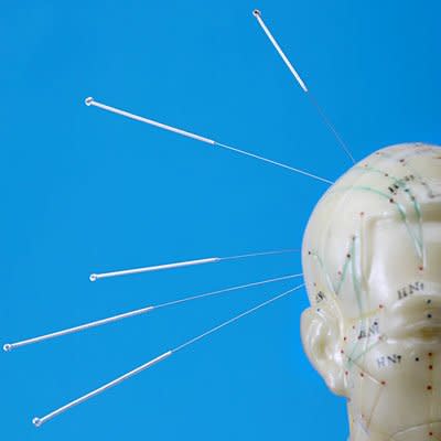 Acupuncture