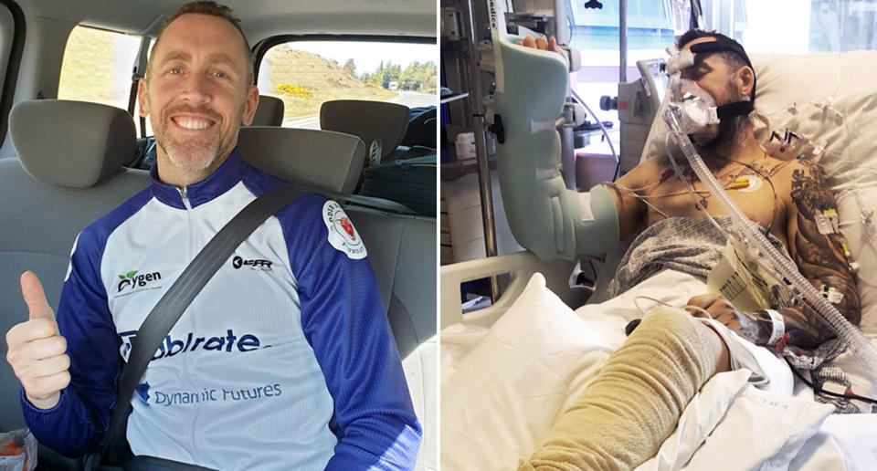 Pictured is Jean-Pierre de Villiers before and after he was the victim of a hit and run. Mr de Villiers was undertaking a charity bike ride from John O’Groats in Scotland to Land’s End in Cornwall when he was hit by a car leaving him with a perforated bowel and punctured lung. He also broke both his legs.