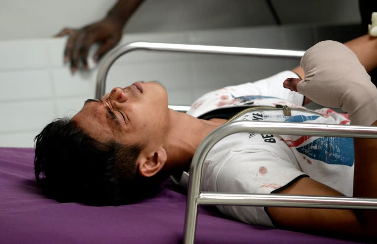 A man injured from fireworks grimaces as he is treated at a hospital in Manila on January 1, 2016