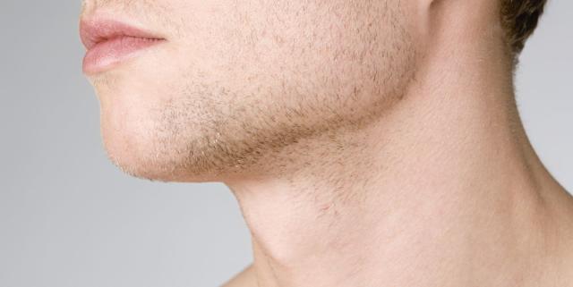 A Doctor Explains Whether 'Jaw Trainers' for Men Actually Work