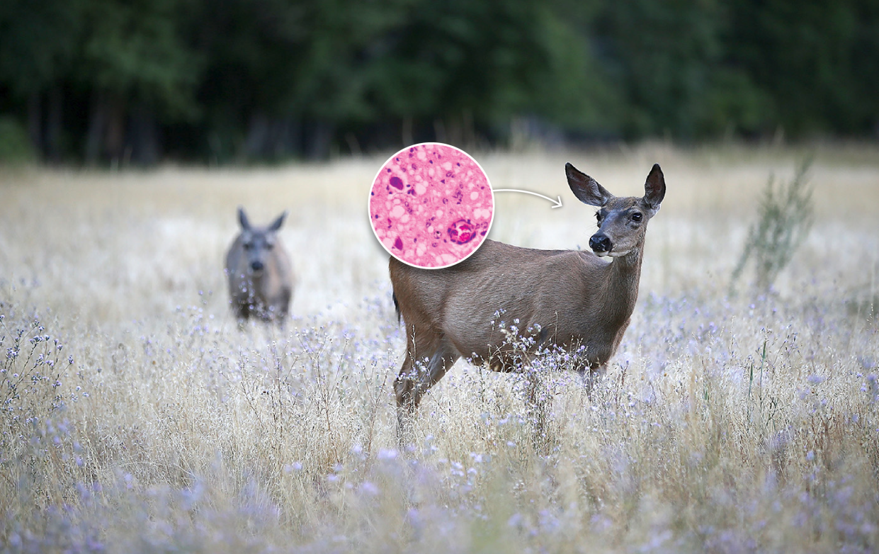 Chronic wasting disease is slowly spreading to deer in the US.