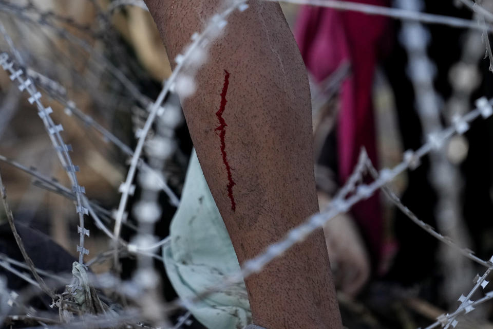 A man bleeds from a cut as he and other migrants climb over concertina wire after they crossed the Rio Grande and entered the U.S. from Mexico, Saturday, Sept. 23, 2023, in Eagle Pass, Texas. (AP Photo/Eric Gay)