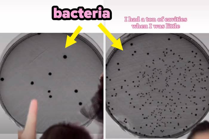 Dr. Joyce's petri dish, full of bacteria, side-by-side with a peer's petri dish with barely any bacteria