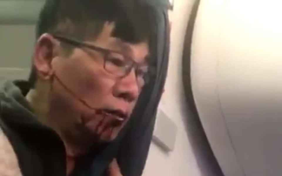 Dr David Dao was injured after being dragged from an overbooked United Airlines flight