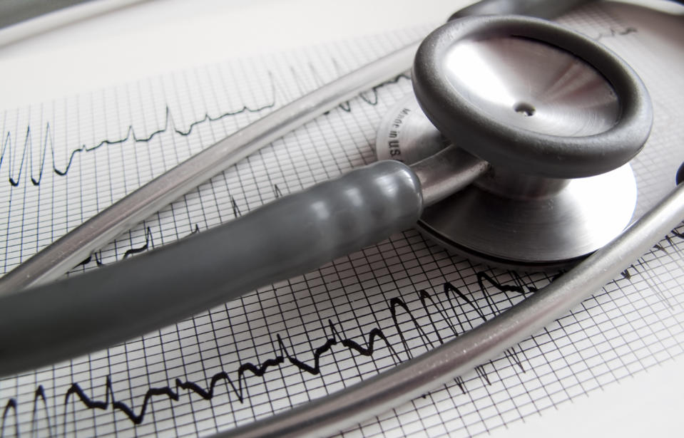 Fewer women are receiving electrocardiogram tests than men after presenting with heart attack symptoms. Source: Getty