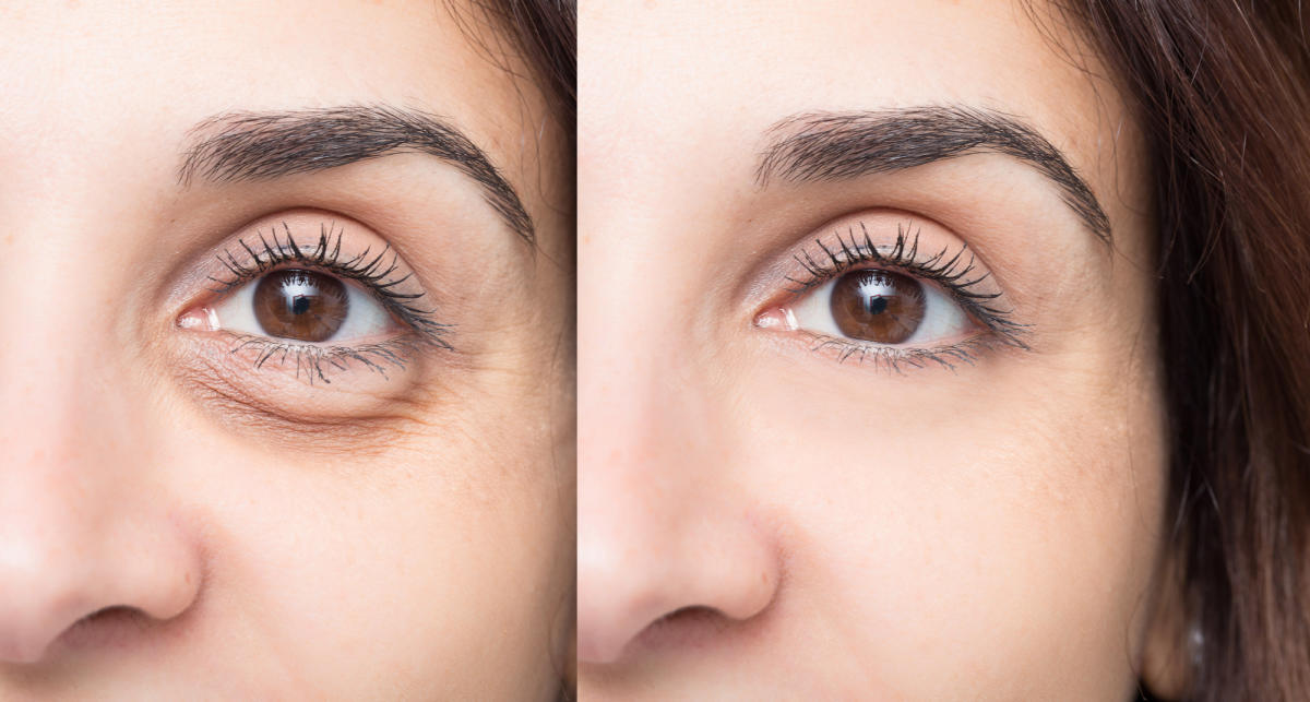 yeux permanents?  Des cils plus épais ?  Cette crème French Time Filler fait tout