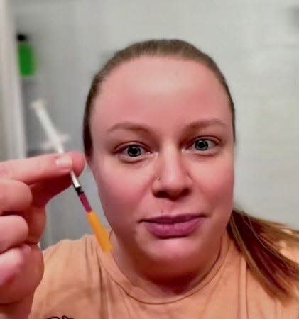 Kelly Swayze, 34, of Trenton, holds a syringe containing a compounded weight-loss drug that is similar to Wegovy. She hopes that using the drug, which has the active ingredient semaglutide, will work to treat obesity and help her stave off Type 2 diabetes.