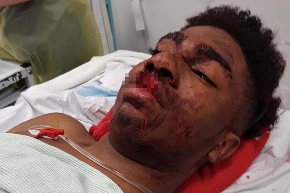 Terrell Decosta Jones-Burton lies seriously injured in hospital. The schoolboy suffered a split lip and bruising to the brain