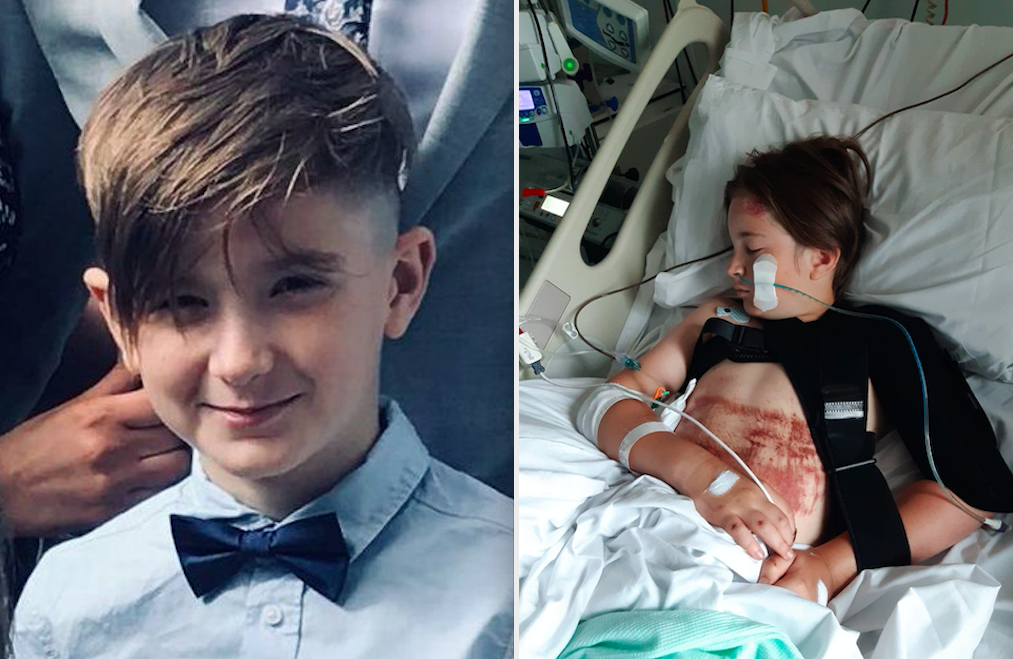 Oliver Davies was left with life-changing injuries following the hit-and-run. (Wales News)