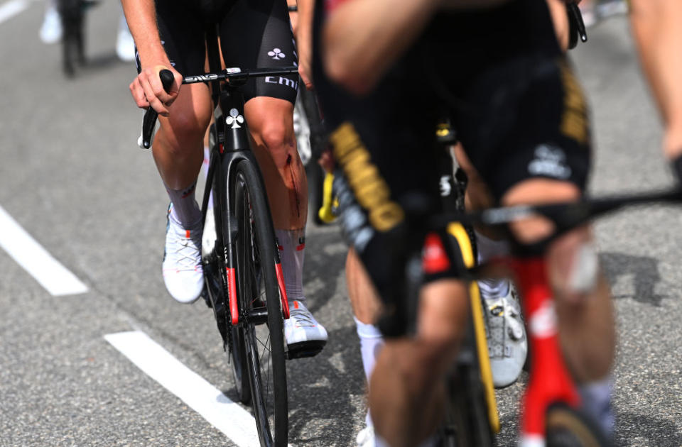 COURCHEVEL FRANCE  JULY 19 Detail view of an injury of Tadej Pogacar of Slovenia and UAE Team Emirates  White Best Young Rider Jersey during the stage seventeen of the 110th Tour de France 2023 a 1657km at stage from SaintGervais MontBlanc to Courchevel  UCIWT  on July 19 2023 in Courchevel France Photo by Tim de WaeleGetty Images