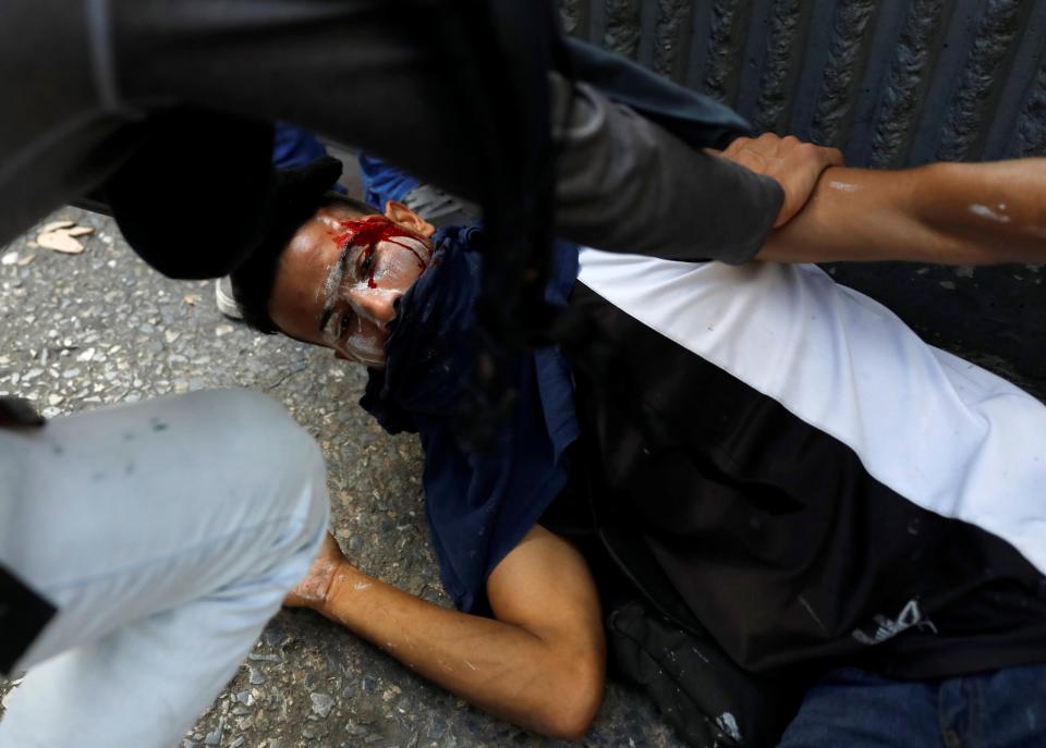 <p>Un manifestante recibe ayuda tras sufrir heridas durante enfrentamientos con la policía antidisturbios en una manifestación en Caracas, Venezuela, 8 de abril de 2017. REUTERS / Carlos Garcia Rawlins</p>