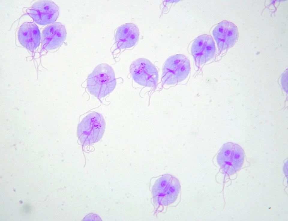 <em>Giardia lamblia</em>. <a href="https://journals.plos.org/plosntds/article?id=10.1371/journal.pntd.0002686" rel="nofollow noopener" target="_blank" data-ylk="slk:Eva Nohýnková, Universidad Carolina;elm:context_link;itc:0;sec:content-canvas" class="link ">Eva Nohýnková, Universidad Carolina</a>, <a href="http://creativecommons.org/licenses/by/4.0/" rel="nofollow noopener" target="_blank" data-ylk="slk:CC BY;elm:context_link;itc:0;sec:content-canvas" class="link ">CC BY</a>