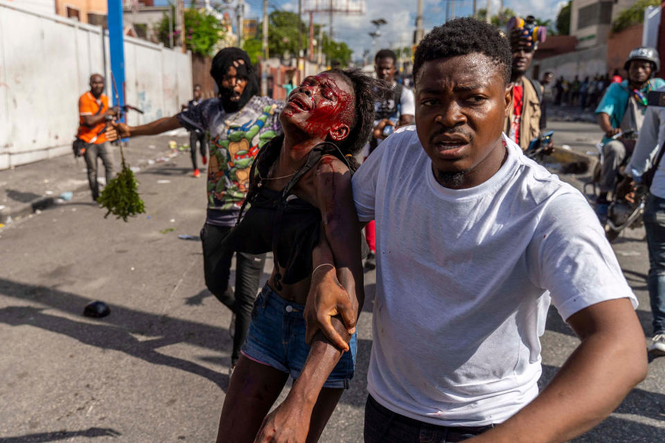 A man assists an injured woman during a protest against Haitian Prime Minister Ariel Henry calling for his resignation, in Port-au-Prince, Haiti, on Oct. 10.<span class="copyright">Richard Pierrin—AFP/Getty Images</span>