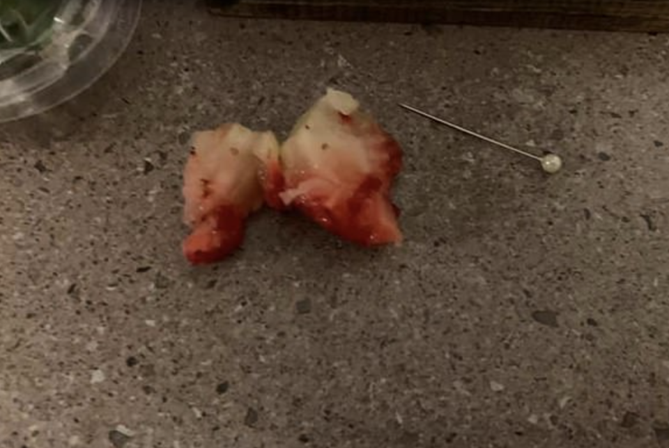 Mother Sophie Mitchell found the needle when her daughter was eating the fruit on Monday night. Source: Facebook