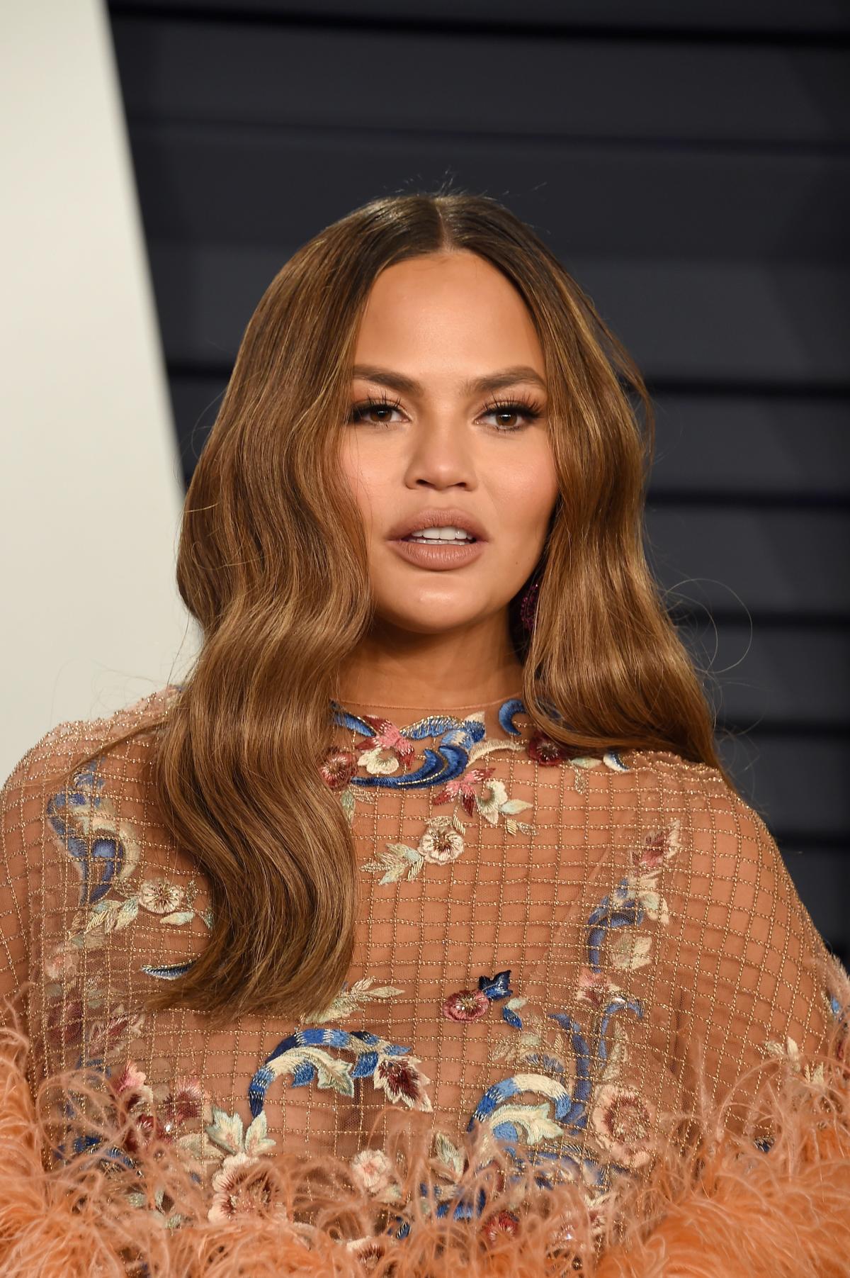 Chrissy Teigen Explained Why She Is Getting Botox While Pregnant