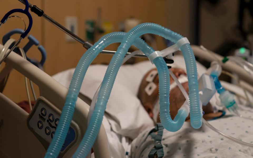 Ventilator tubes are attached to a COVID-19 patient at Providence Holy Cross Medical Center in the Mission Hills section of Los Angeles. - Jae Hong/AP