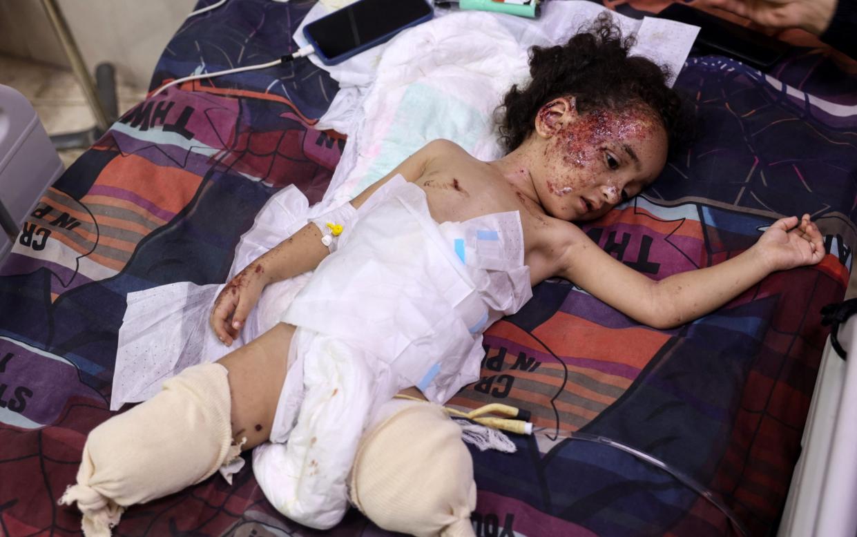 Palestinian child Hanan lies in a bed at the Al-Aqsa Martyrs hospital in Deir el-Balah in the central Gaza Strip on September 8, 2024