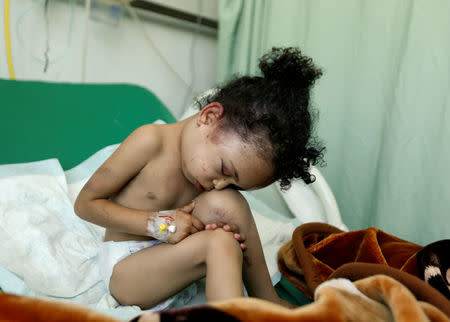 Buthaina Muhammad Mansour, believed to be four or five, sits on a bed at a hospital after she survived a Saudi-led air strike that killed eight of her family members in Sanaa, Yemen August 26, 2017. REUTERS/Khaled Abdullah