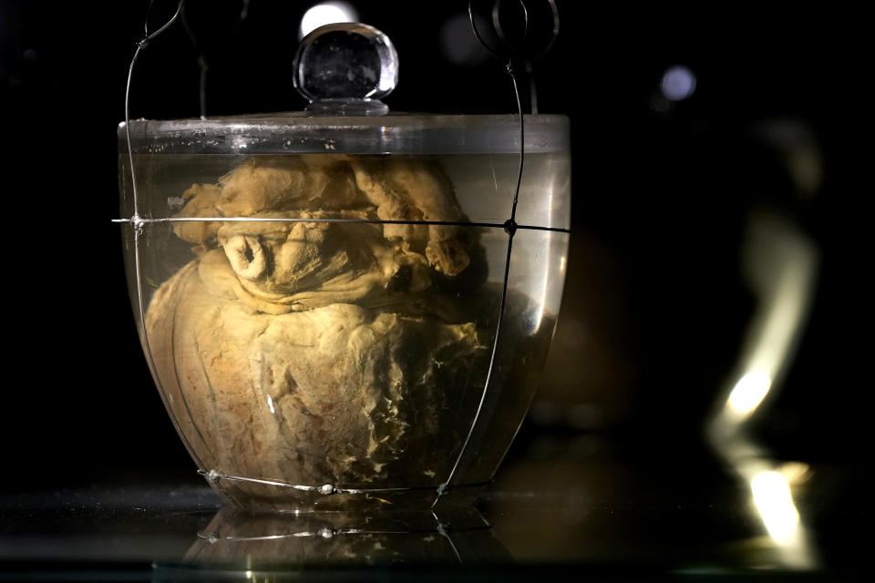 The embalmed heart of Brazil's former emperor Dom Pedro I is displayed in a container of formaldehyde, during a press visit at Itamaraty palace in Brasilia, Brazil, Wednesday, Aug. 24, 2022. The heart of the emperor who declared Brazil's independence in 1822 arrived from Portugal for display as part of Brazil's independence bicentennial celebration on Sept. 7. (AP Photo/Eraldo Peres)