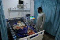 A coronavirus patient receives treatment at a hospital in Najaf, Iraq, Wednesday, July 14, 2021. Infections in Iraq have surged to record highs amid a third wave spurred by the more aggressive delta variant, and long-neglected hospitals suffering the effects of decades of war are overwhelmed with severely ill patients. (AP Photo/Anmar Khalil)