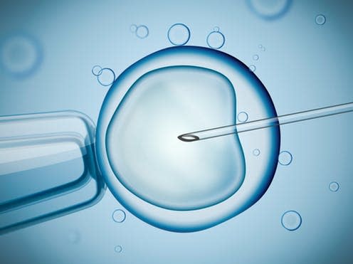 <span class="caption">In vitro fertilisation.</span> <span class="attribution"><a class="link " href="https://www.shutterstock.com/download/confirm/362617526?src=hVbYuylijRN7zGzsslA1WA-1-7&size=medium_jpg" rel="nofollow noopener" target="_blank" data-ylk="slk:vchal/Shutterstock;elm:context_link;itc:0;sec:content-canvas">vchal/Shutterstock</a></span>