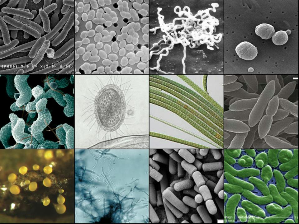 Diversos tipos de bacterias. <a href="https://commons.wikimedia.org/wiki/File:Bacteria_collage.jpg" rel="nofollow noopener" target="_blank" data-ylk="slk:148LENIN / Wikimedia Commons;elm:context_link;itc:0;sec:content-canvas" class="link ">148LENIN / Wikimedia Commons</a>, <a href="http://creativecommons.org/licenses/by-sa/4.0/" rel="nofollow noopener" target="_blank" data-ylk="slk:CC BY-SA;elm:context_link;itc:0;sec:content-canvas" class="link ">CC BY-SA</a>