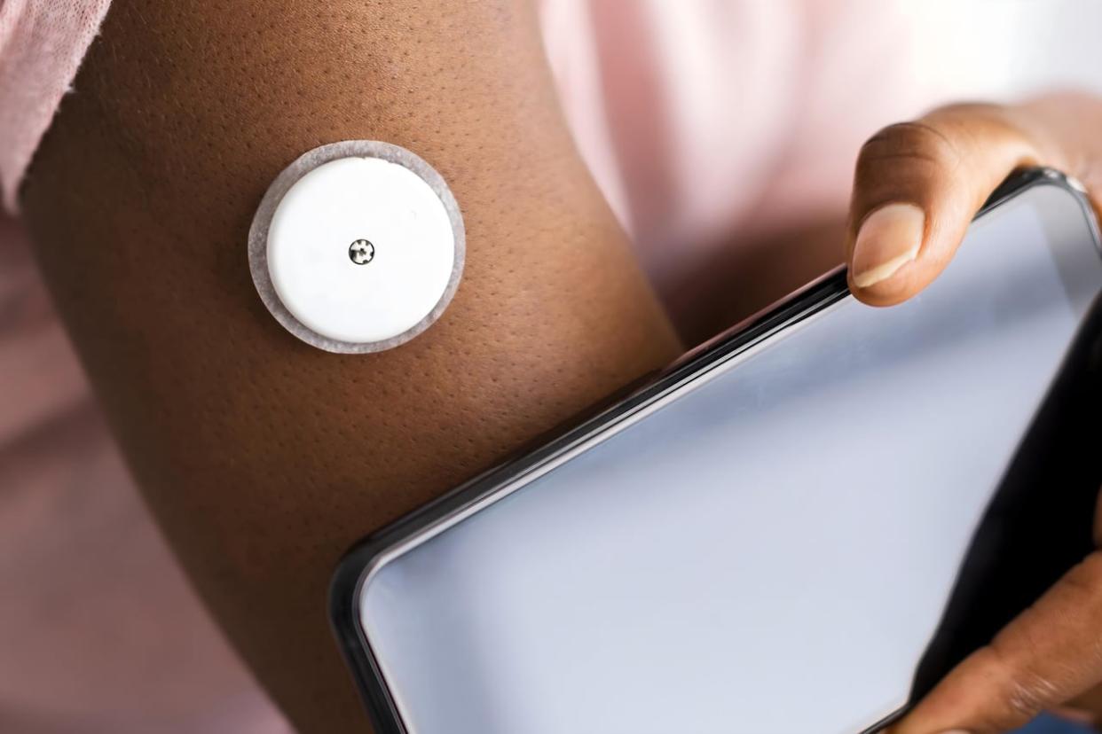 A woman testing glucose level with a Continuous Glucose Monitor. The devices were developed for people with diabetes but are now being marketed as biometric wearable technology.  (Pond5 - image credit)