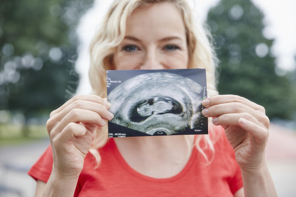 Mujer embarazada muestra un ultrasonido de su bebé. 
