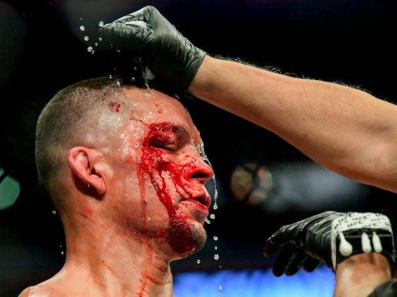 Diaz received cuts above and below the eye against Masvidal (Getty)