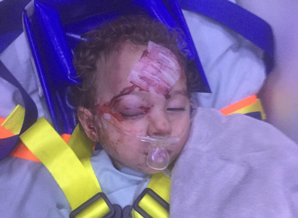 Logan Grieve, 2, was playing in the backyard of his family home in Katherine, Northern Territory, when he was mauled by his family's Bull Mastiff cross. Source: Supplied/ Shannon Coutts