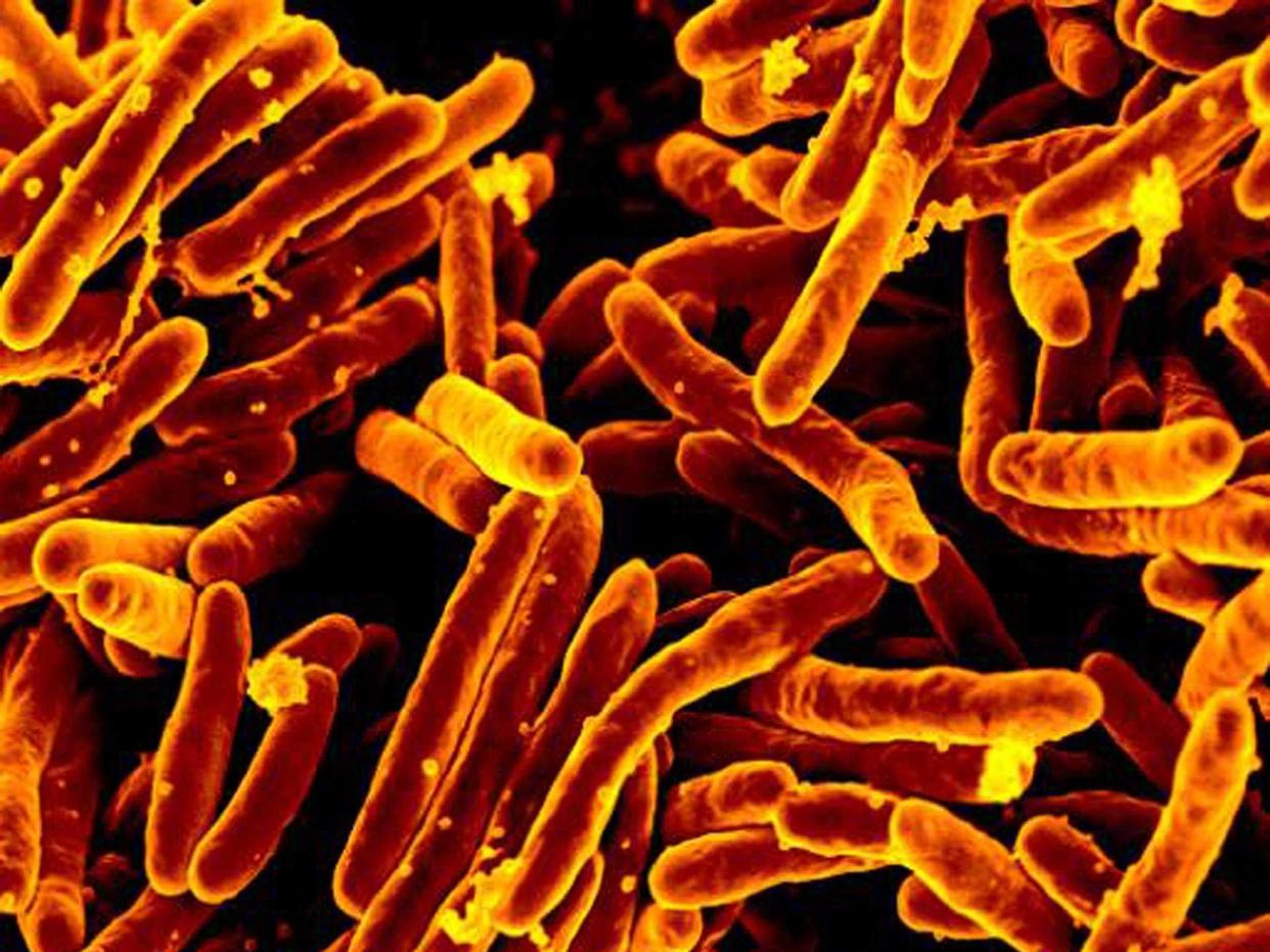 tuberculosis bacteria