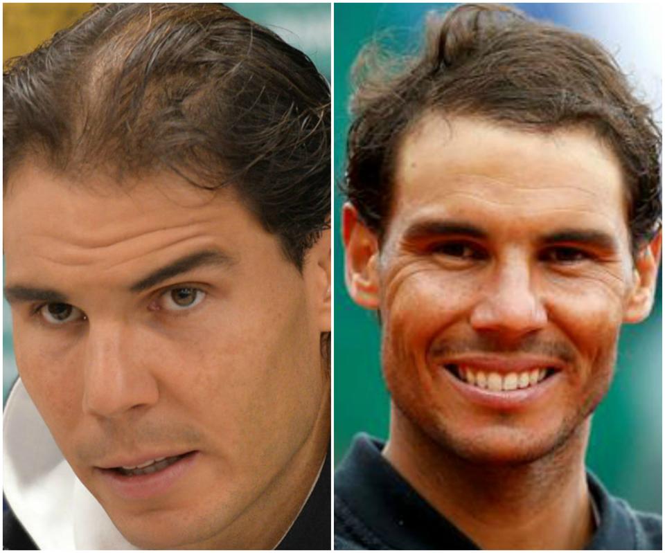 Rafa Nadal