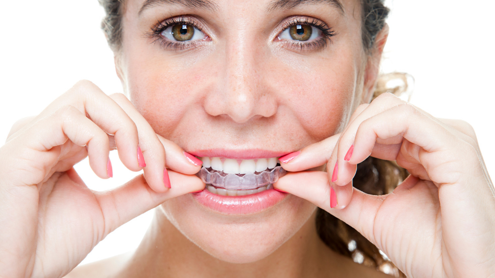 Five things you should know before getting invisible braces