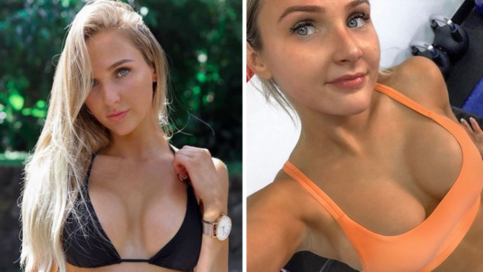 Curse of the Love Island boob job as stars left with wonky nipples