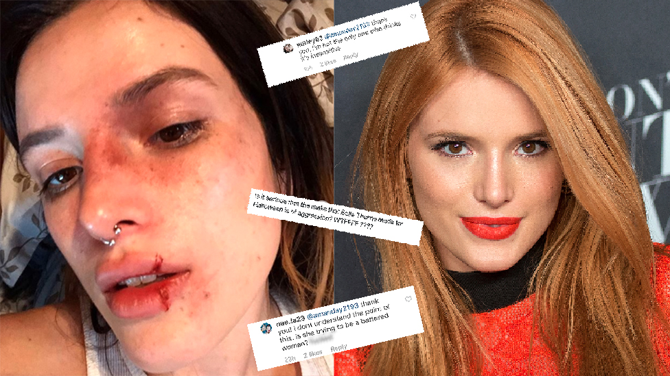 Bella accused of 'glamorizing being abused' with bloody Halloween makeup